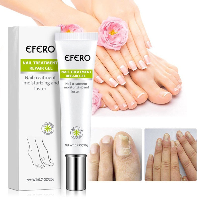 Gel Reparador de Unhas