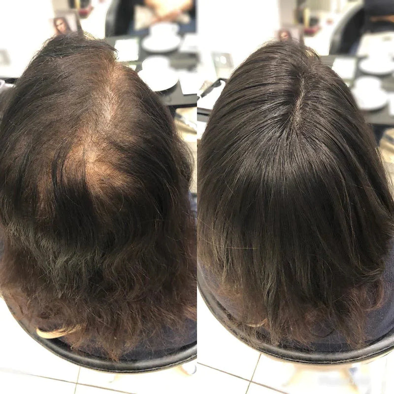 Topo de Cabeça - Fibra Orgânica Para Alopecia, Falhas, Cabelos Ralos e com Queda